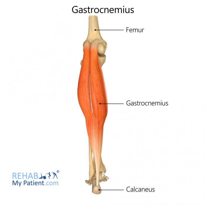 Which muscle is highlighted below