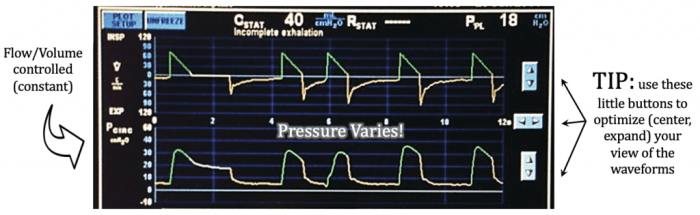 High pressure ventilator alarm causes