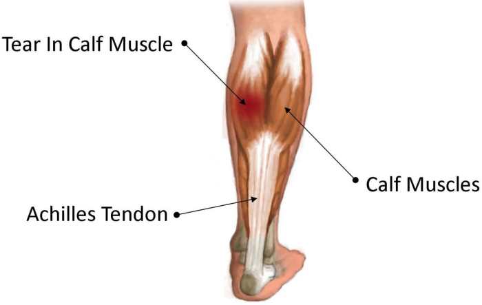 Which muscle is highlighted below